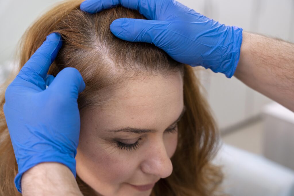 PRP Hair Treatment
