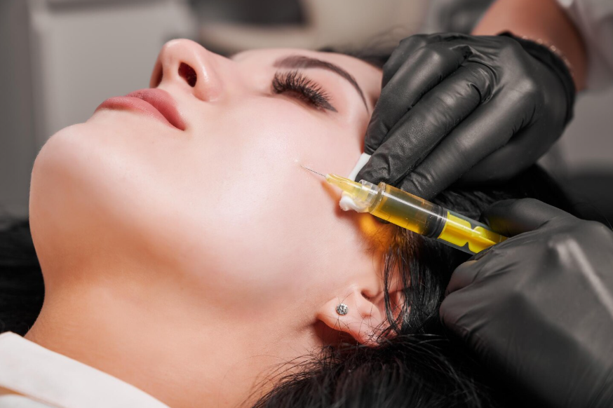 PRP Microneedling in Omaha