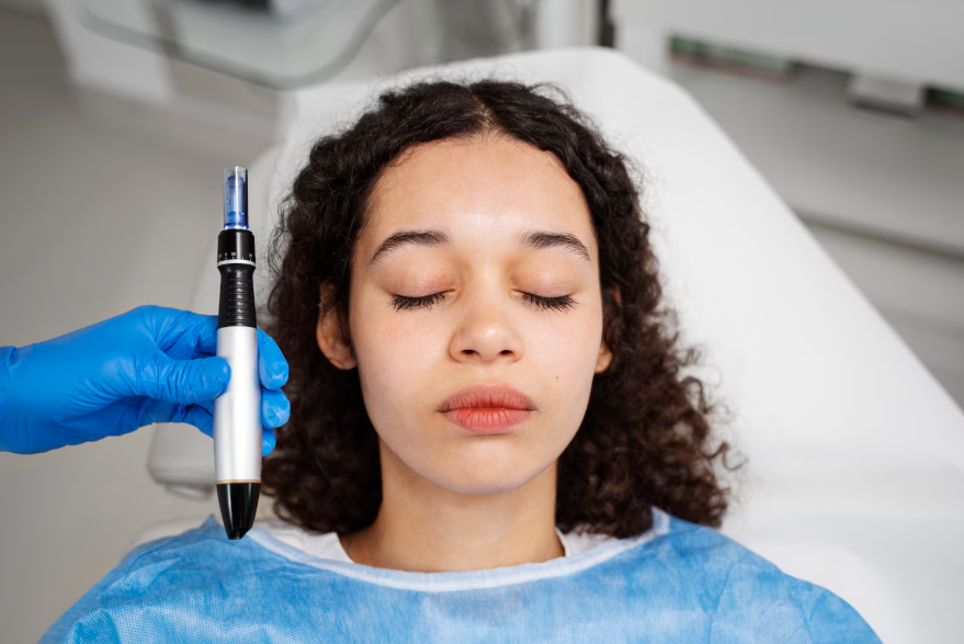 Microneedling in Omaha